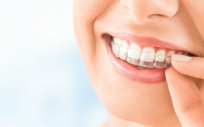 Prozirni aparatić za zube – prijatelj Vašeg osmijeha