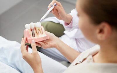 Sve što trebate znati o zubnim implantatima