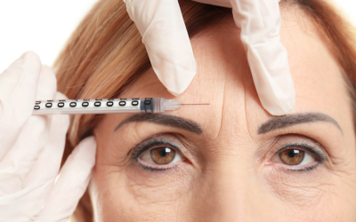 Botox vs Dermalni Fileri