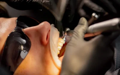 Pjeskarenje zubi: klinička checklista prije i poslije (mrlje, kamenac, osjetljivost, održavanje)