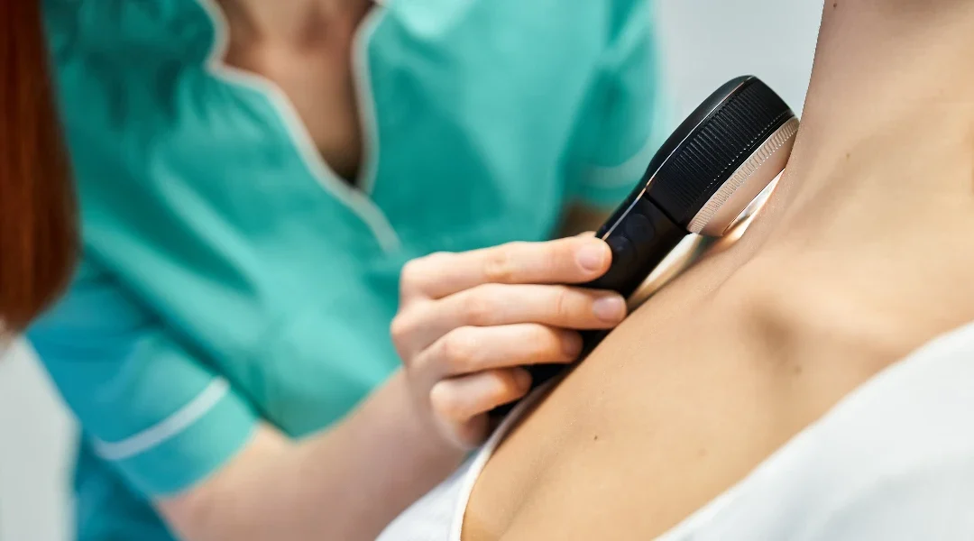 Virusne bradavice: mali vodič za pacijente