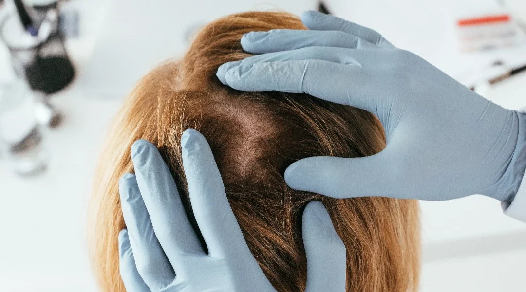 PRP vlasišta: realna mapa očekivanja (3–12 mjeseci)